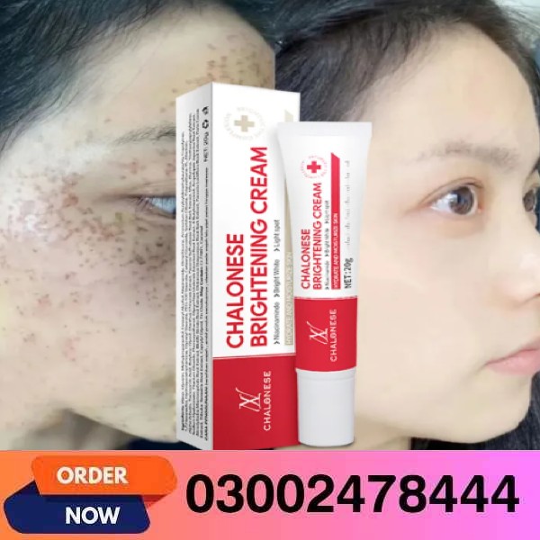 Chalonese Cream In Pakistan